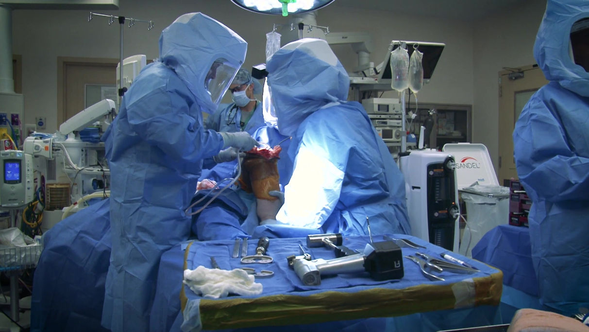 Knee Replacement POV